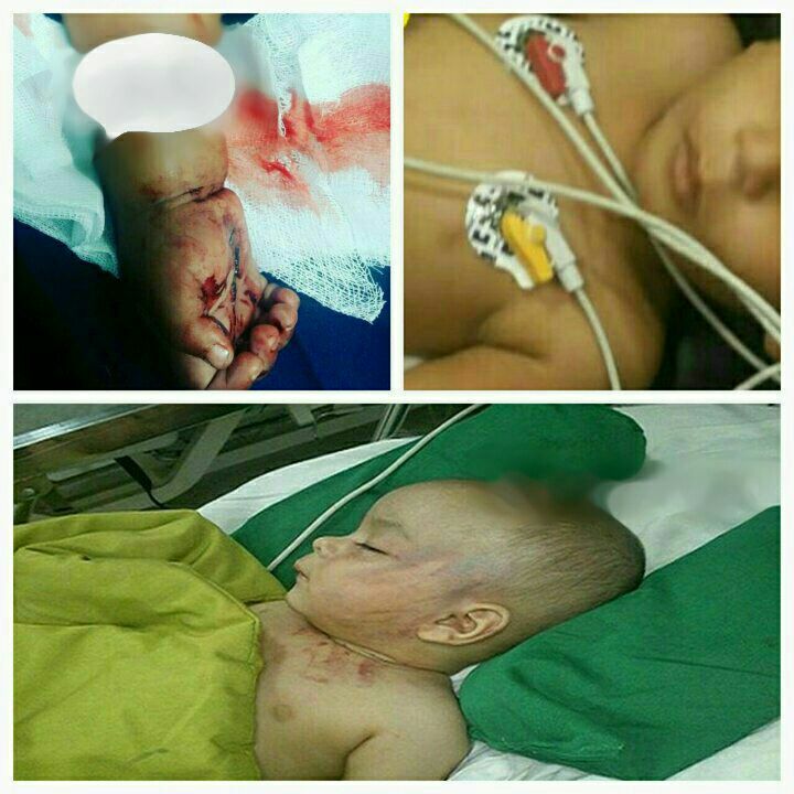 آخرین وضعیت پرونده کودک آزاری سیرجان/ بازداشت مادر و انتقال کودک به شیرخوارگاه